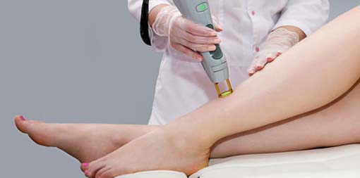 LASER HAIR REMOVAL